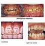 Anomali Adalah Contoh